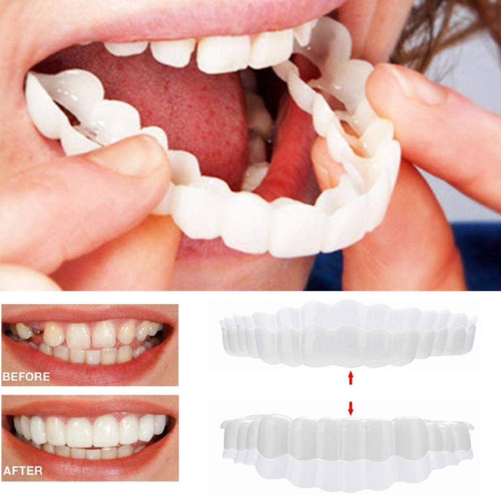 Snap-On Smile Veneers Set