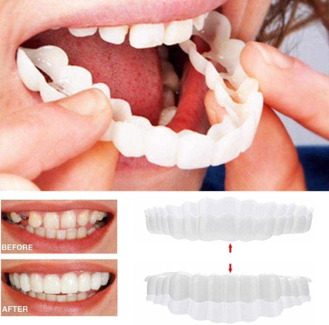 Snap-On Smile Veneers Set