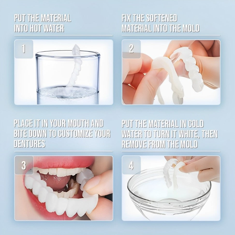 Snap-On Smile Veneers Set