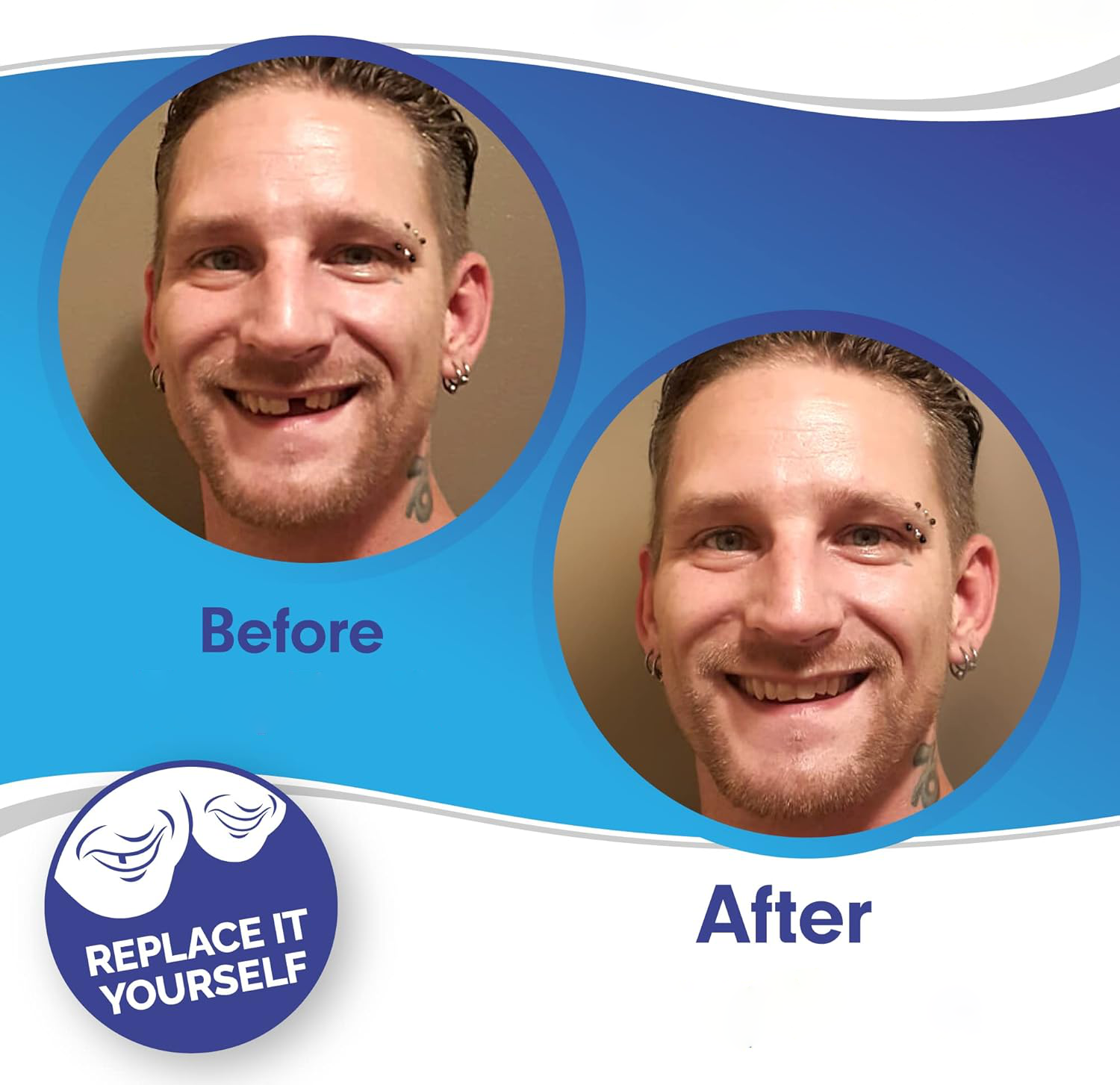 Snap-On Smile Veneers Set