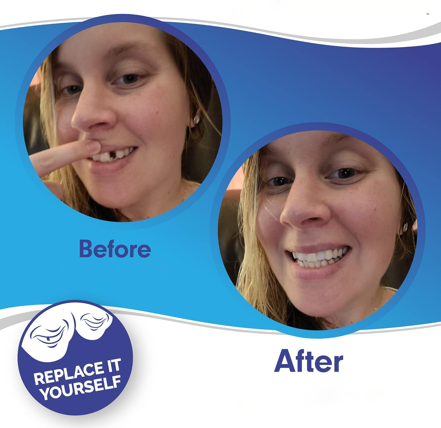 Snap-On Smile Veneers Set