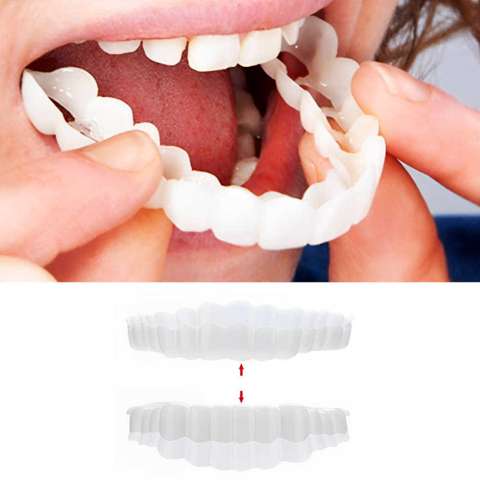 Snap-On Smile Veneers Set